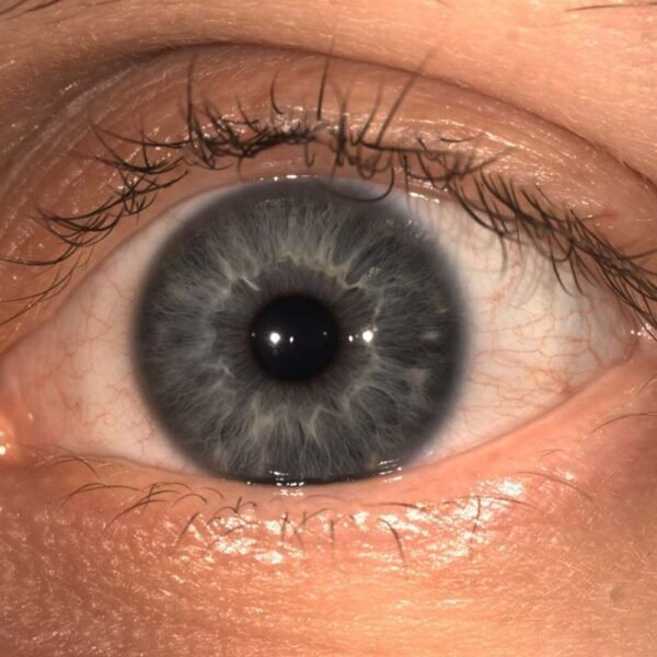 MERIDIA PROFESSIONAL