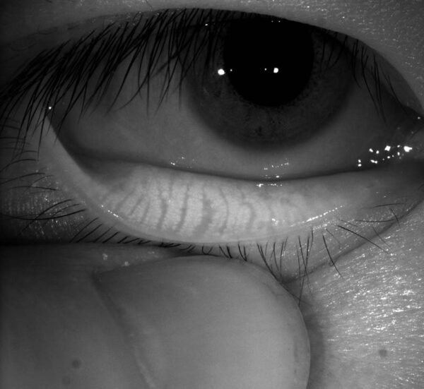 MERIDIA PROFESSIONAL