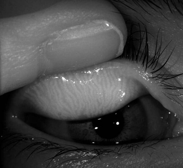 MERIDIA PROFESSIONAL