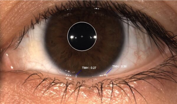 MERIDIA PROFESSIONAL